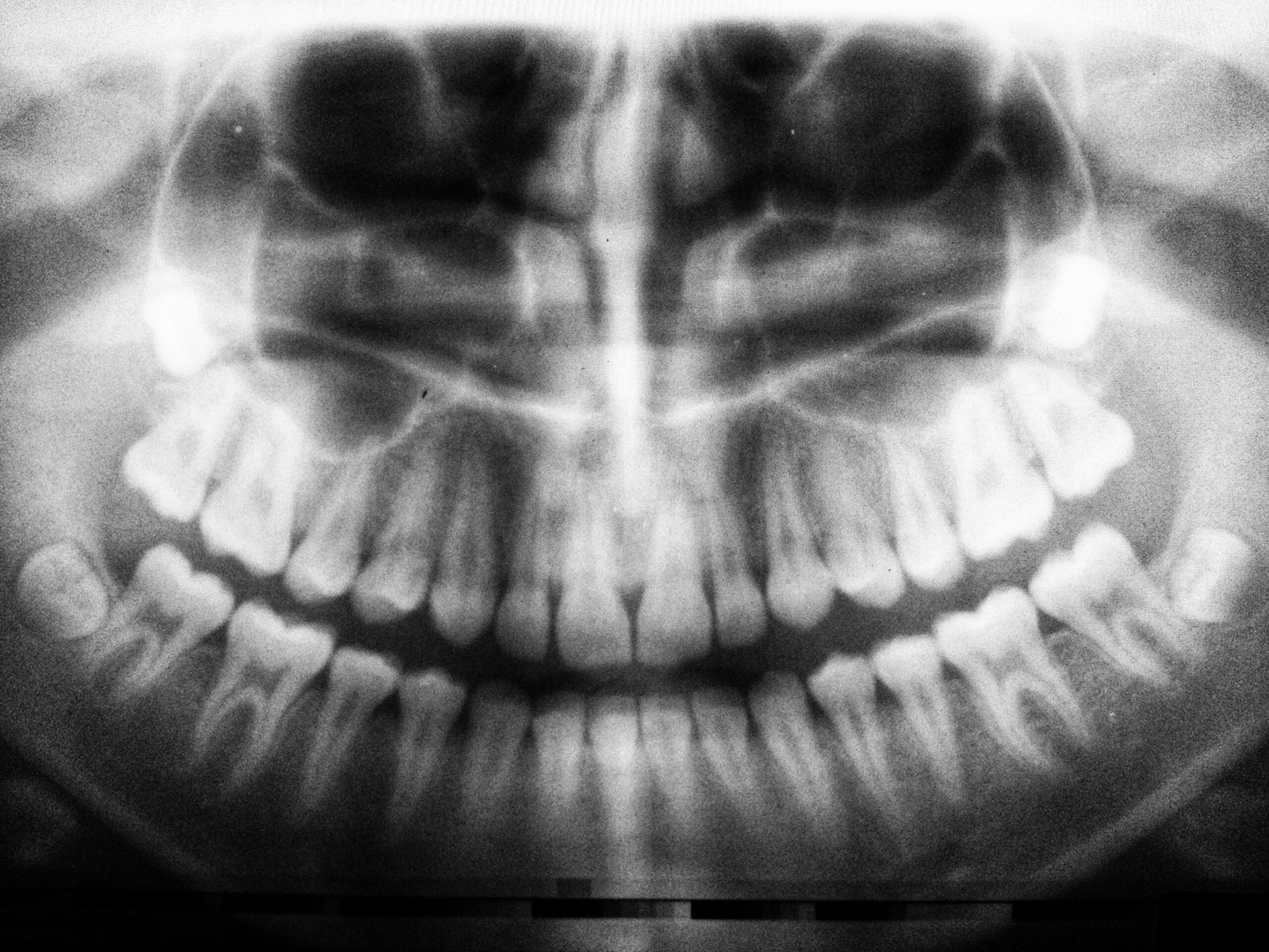 Cat Dental Chart: Key Insights for Your Cat’s Dental Health.